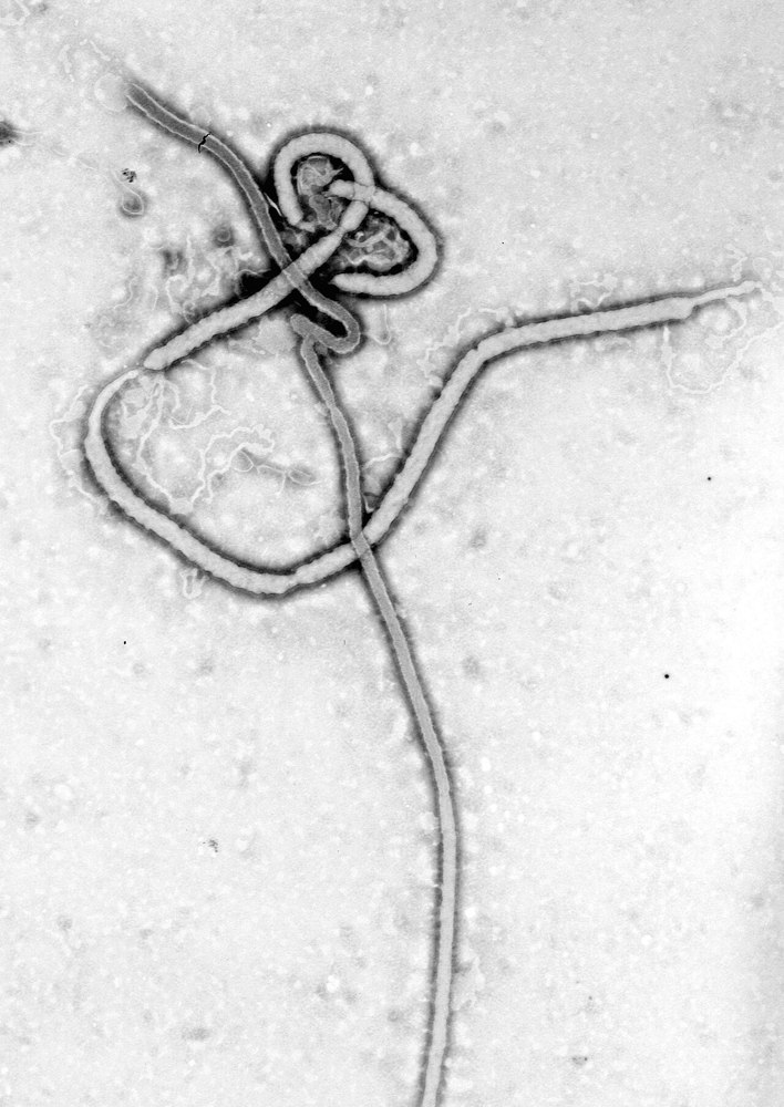 Cross-border Ebola outbreak prompts expanded African response plan